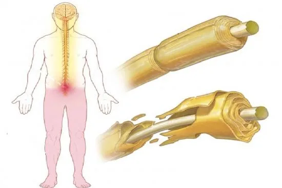 ما هي الأعراض الرئيسية؟ 2026 ما هي الأعراض الرئيسية؟ 2026