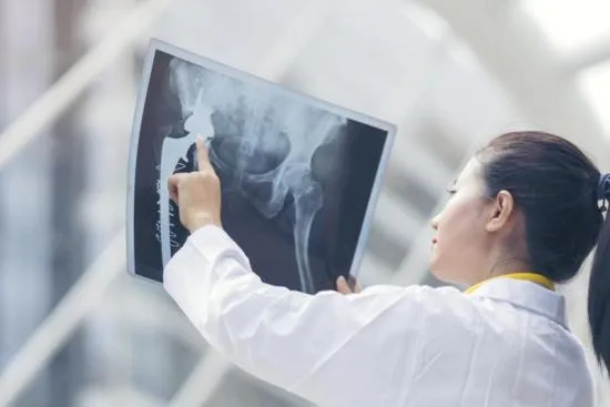 Sarcoma osteogénico