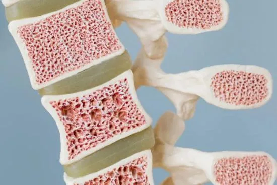 Tratamiento del cáncer de huesos en Turquía