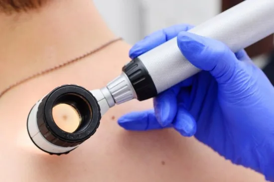 Symptoms and early diagnosis of skin cancer 2026 Symptoms and early diagnosis of skin cancer 2026