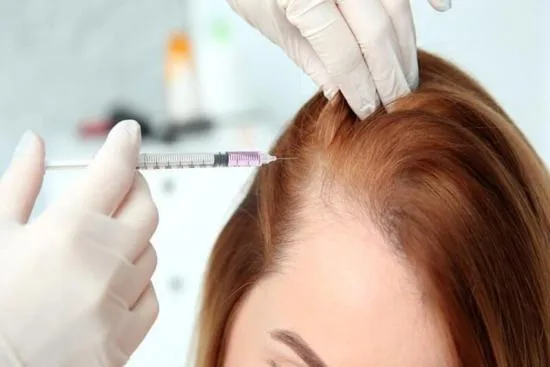 Androgenetic alopecia: What is it? 2026 Androgenetic alopecia: What is it? 2026