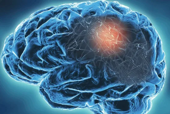 Causes of epileptic seizures 2026 Causes of epileptic seizures 2026