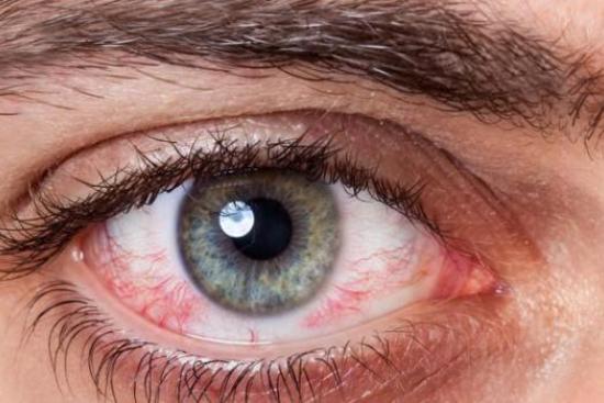 Treatment of retinitis pigmentosa