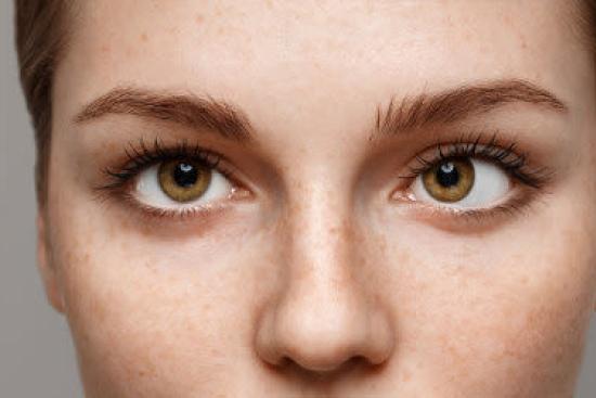 Strabismus treatment